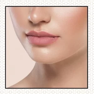 qyoutis probleemhuid acne fillers